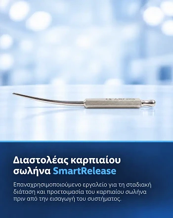 Διαστολέας καρπιαίου σωλήνα