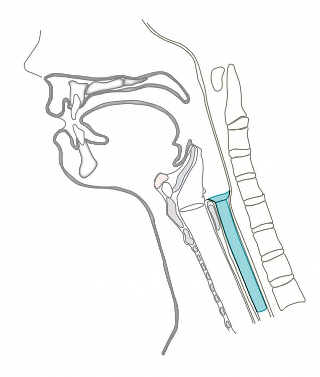 Σωλήνας Bypass Salivary