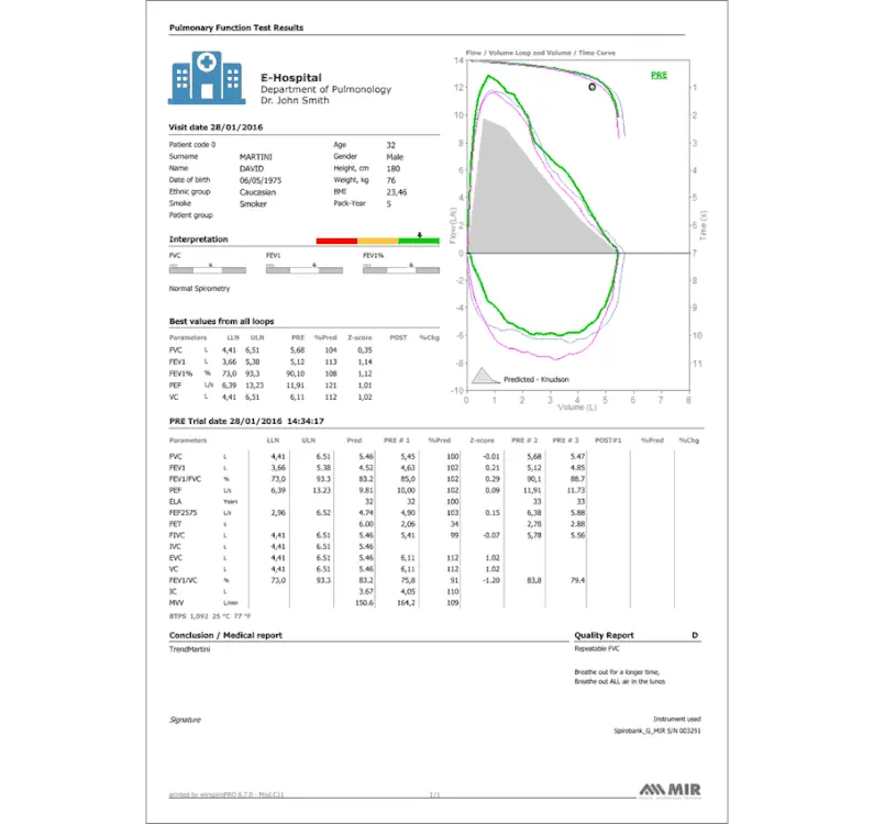 Disposable Spirometer Mir Minispir (60Turbines)