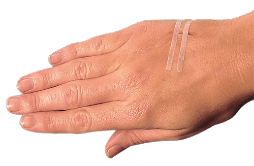 Steri Strip