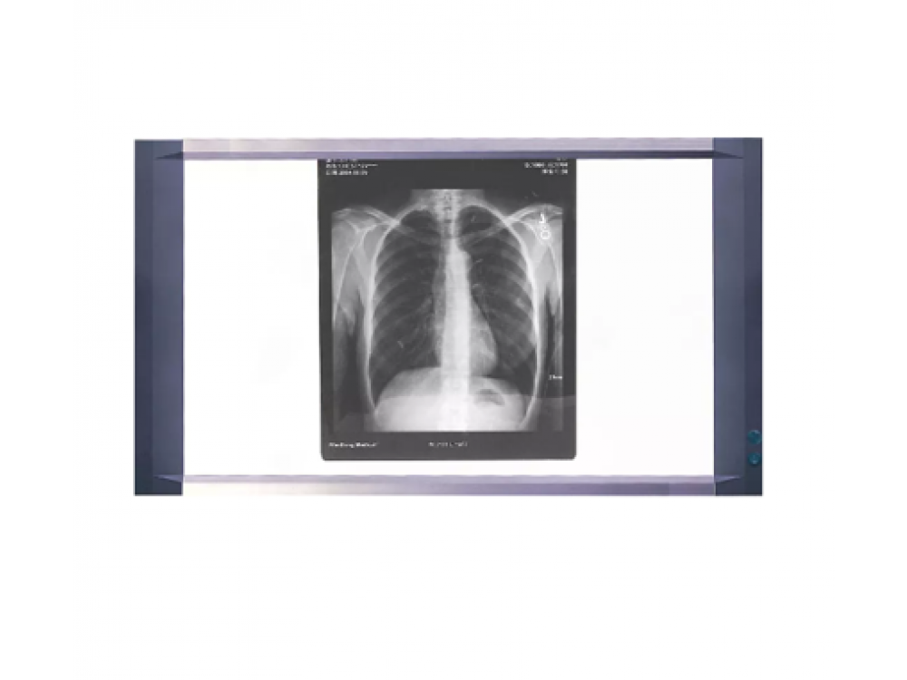 LED LCD 2-Screen X-ray Viewer