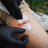 Wound Closure Kit