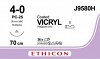 Vicryl