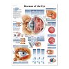 Eye Diseases Poster